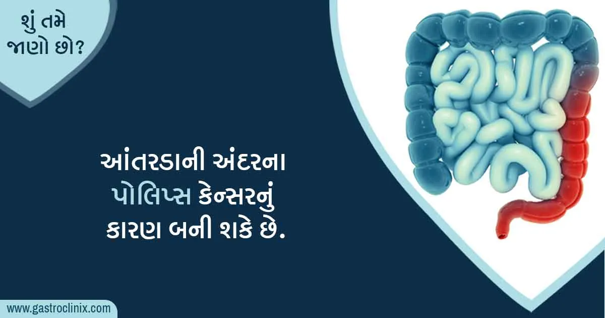 આંતરડામાં થતી ફોલ્લીઓ કોલન પોલિપ્સ