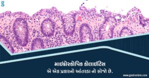 25. માઇક્રોસ્કોપિક કોલાઇટિસ Blog