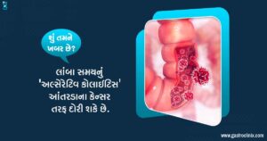 27.પુખ્તવયના લોકોમાં મોટાઆંતરડામાં ચાંદી blog 1