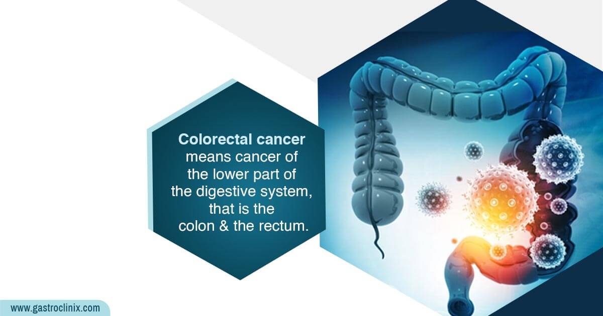 Colon and Rectal Cancer - Dr. Harsh J Shah