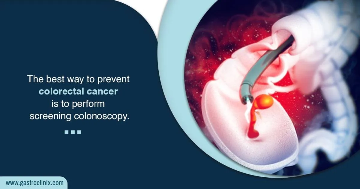 Colorectal Cancer Screening