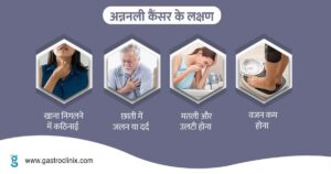Esophagus specialist in India