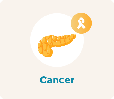 Pancreas Cancer