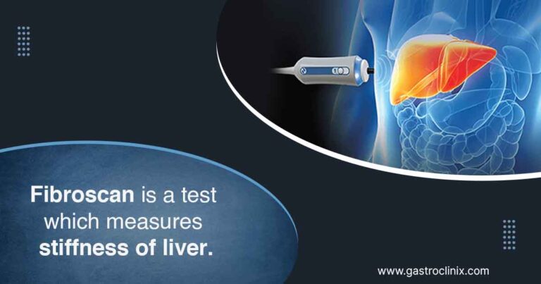 Fibroscan - Dr. Harsh J Shah