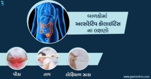 અલ્સેરેટિવકોલાઇટીસ ના બેસ્ટ ડૉક્ટર