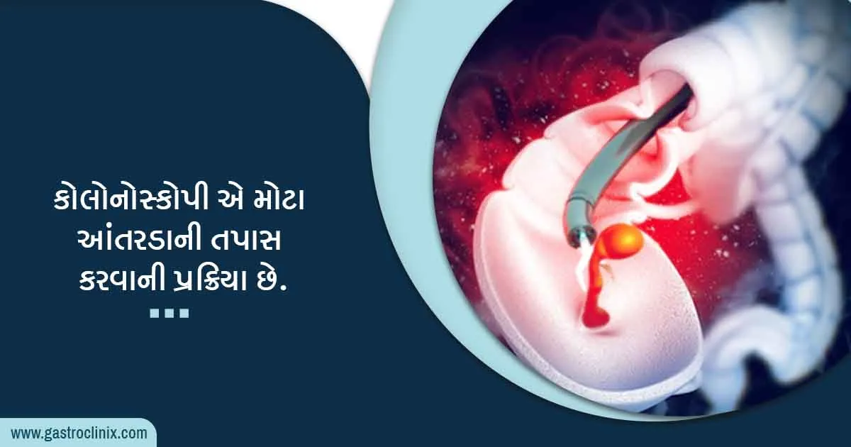 કોલોરેક્ટલ કેન્સર માટે સ્ક્રીનિંગ - Colorectal Cancer Screening in Gujarati