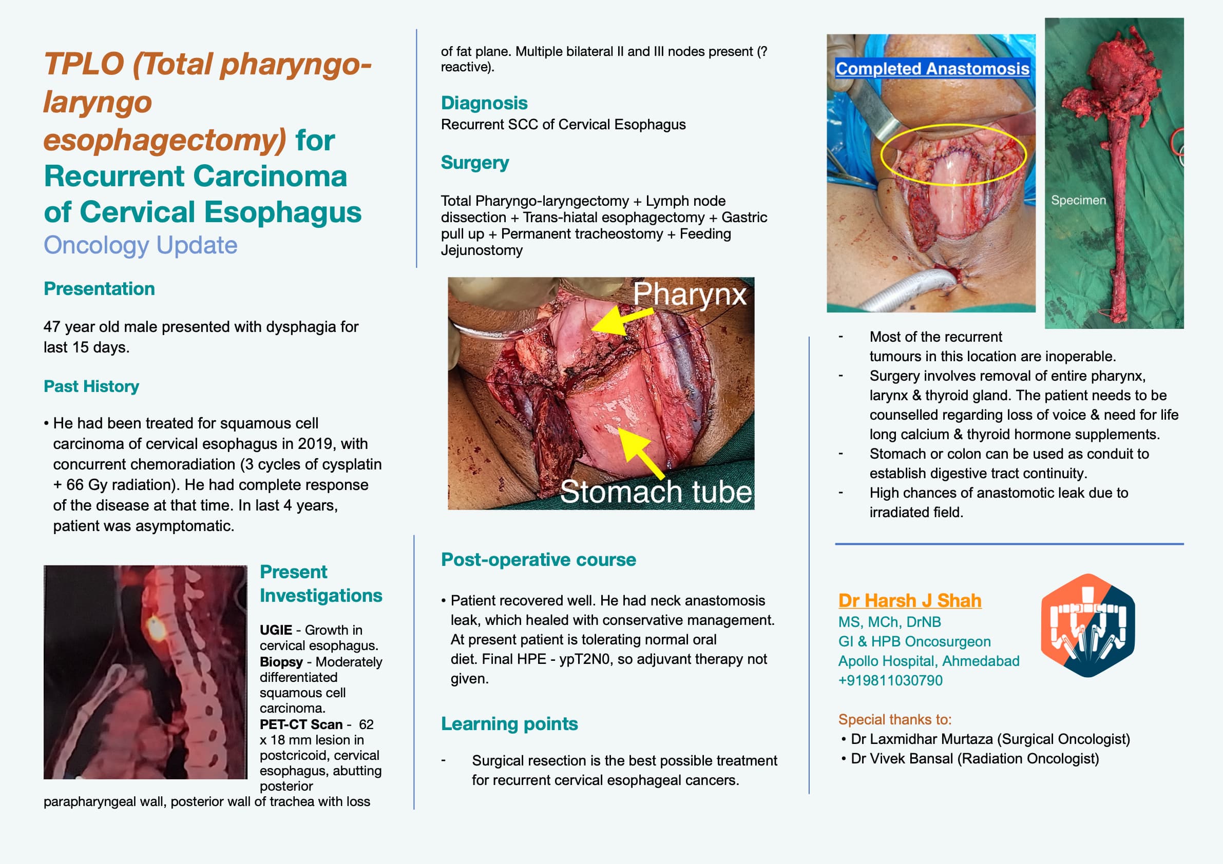TPLO (Total pharyngo-laryngo esophagectomy) for Recurrent Carcinoma of Cervical Esophagus