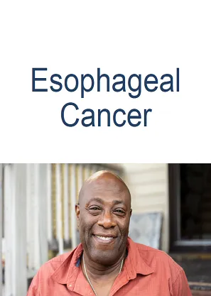 esophageal cancer patient book by dr harsh shah