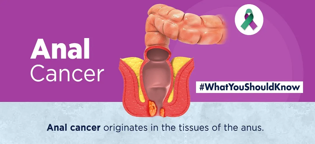 Anal cancer infographic What you should know 1