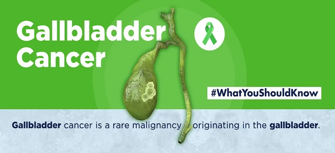 Gallbladder cancer - infographic - What you should know