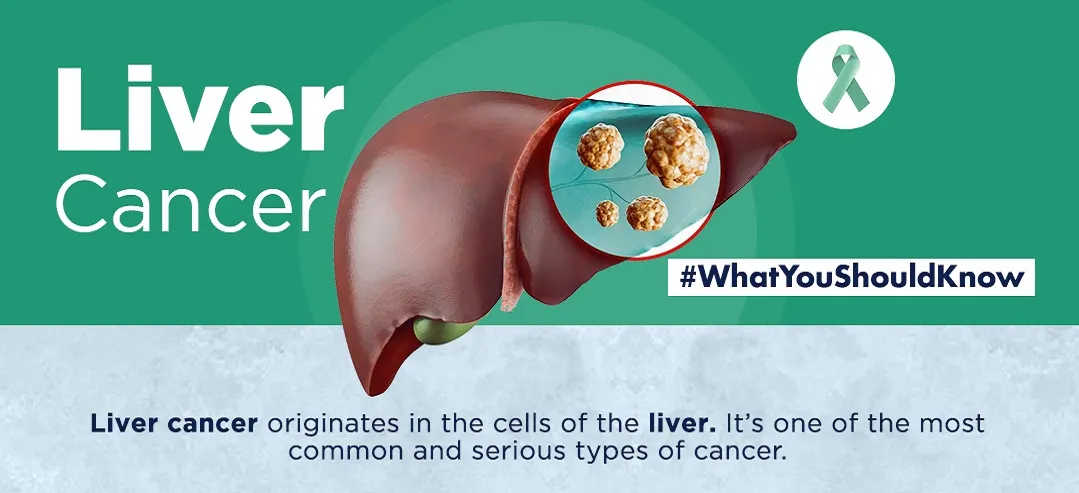 Liver cancer - infographic - What you should know