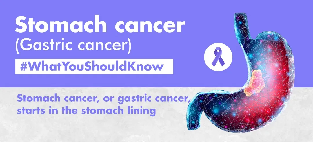 Stomach cancer infographic - What you should know