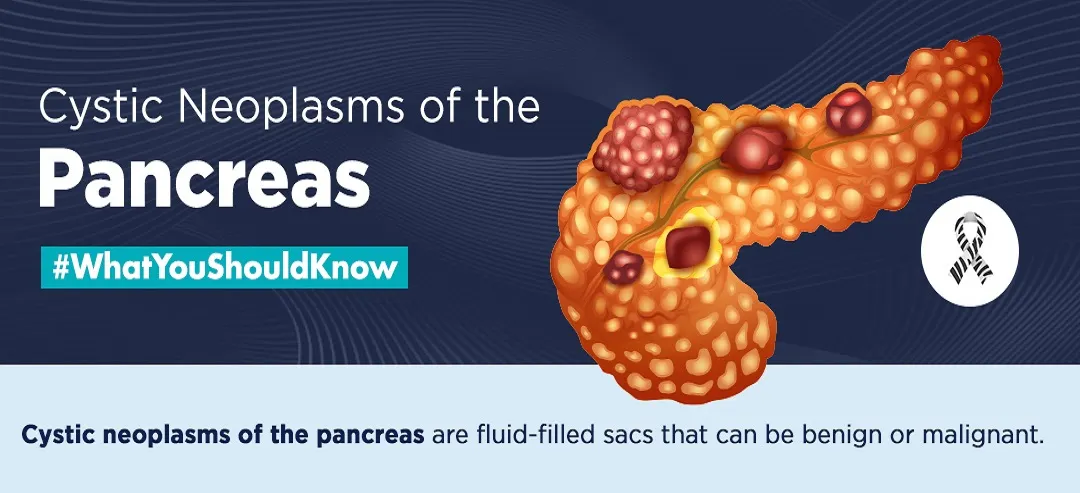 Cystic Neoplasms of the Pancreas