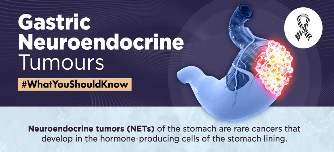 Gastric Neuroendocrine Tumours 1