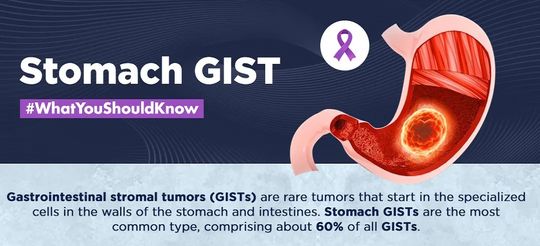 Gastrointestinal stromal tumors (GISTs)