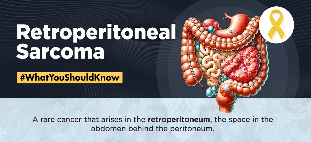 Retroperitoneal Sarcoma 1