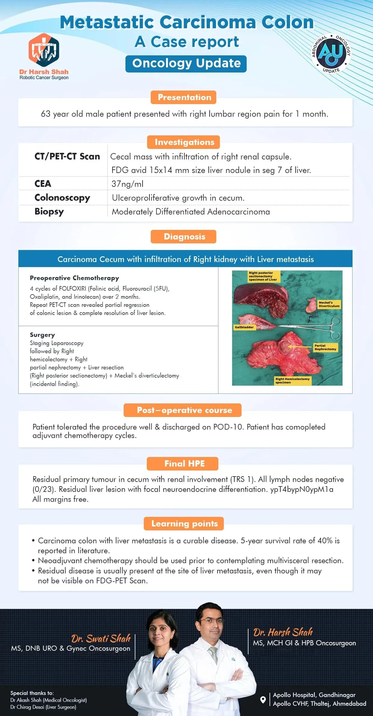 Metastatic Carcinoma colon A case report By Dr Harsh Swati Shah