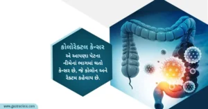 કોલોરેક્ટલ કેન્સર