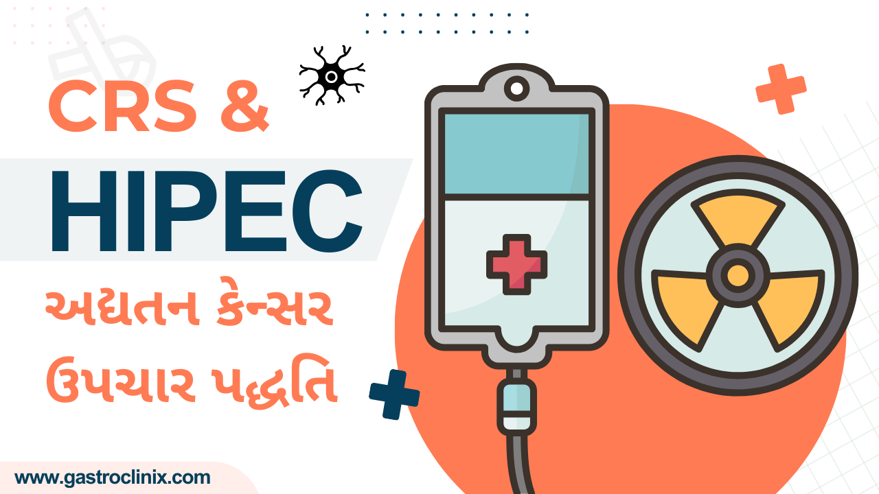 CRS અને HIPEC સર્જરી