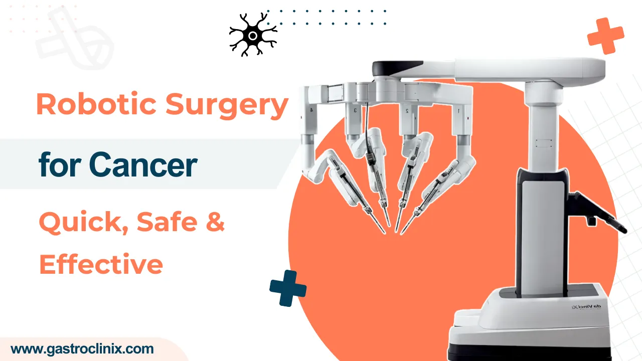 Robotic Surgery For Cancer