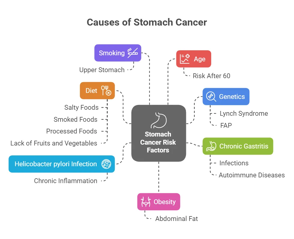 Stomach cancer causes